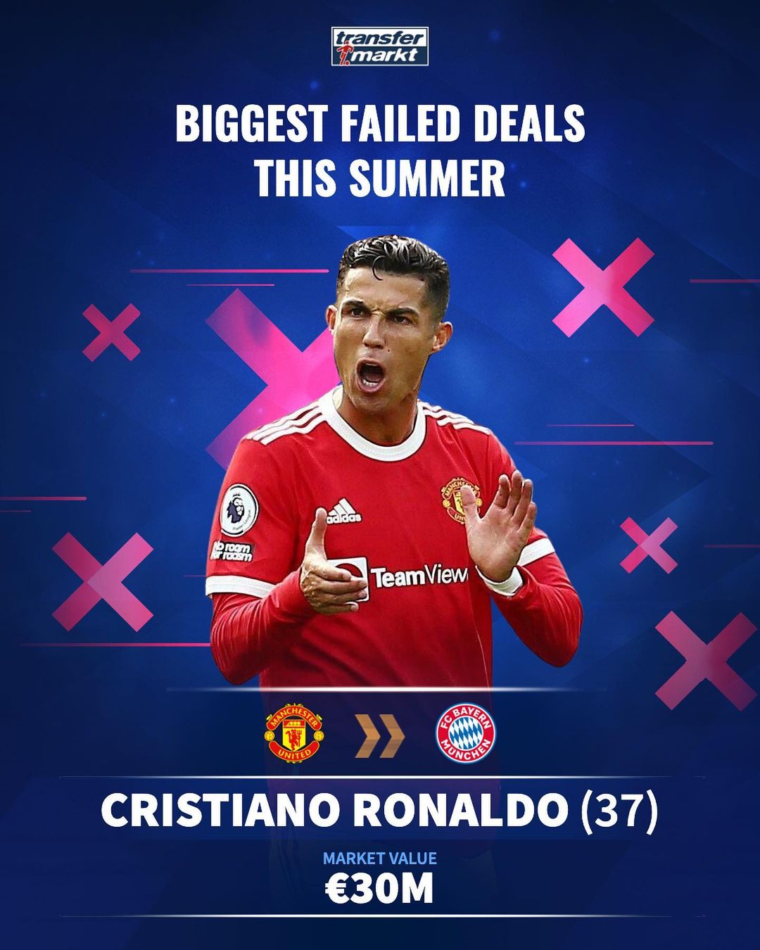 杆或渐进式 杆或渐进式